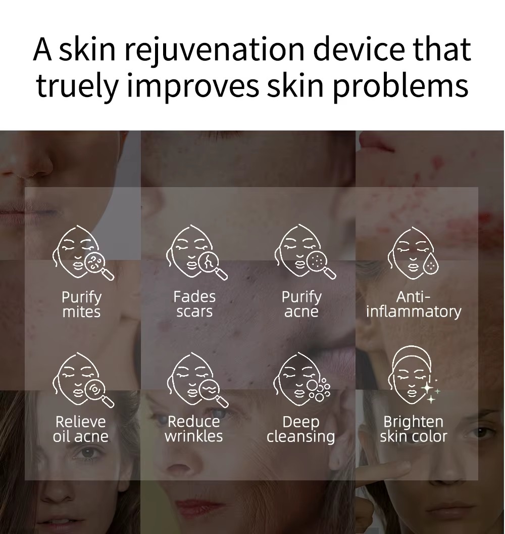 XSP005 plasma beauty device (5)