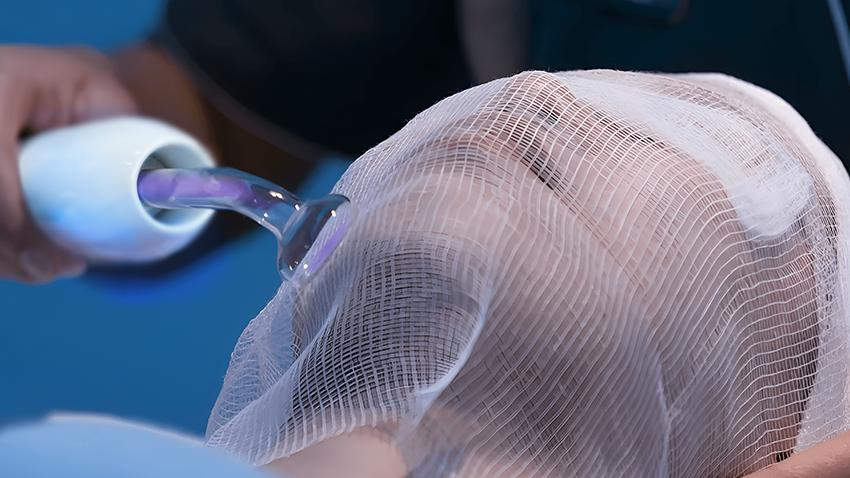 high‑frequency wand, tsalon operation